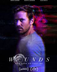 Раны (2019)